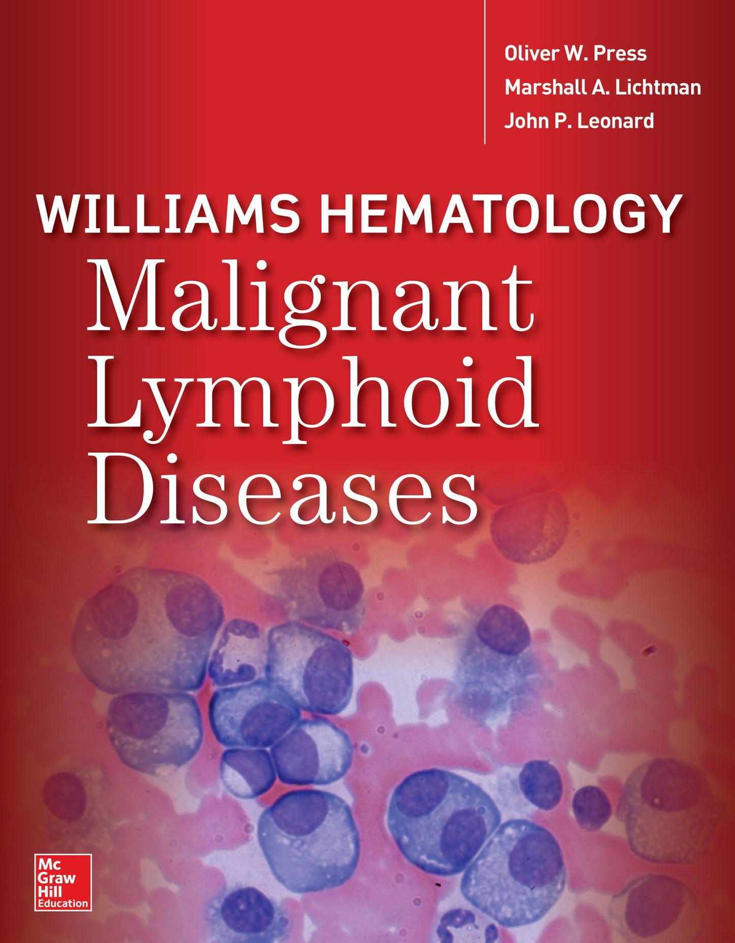 Williams Hematology Malignant Lymphoid Diseases