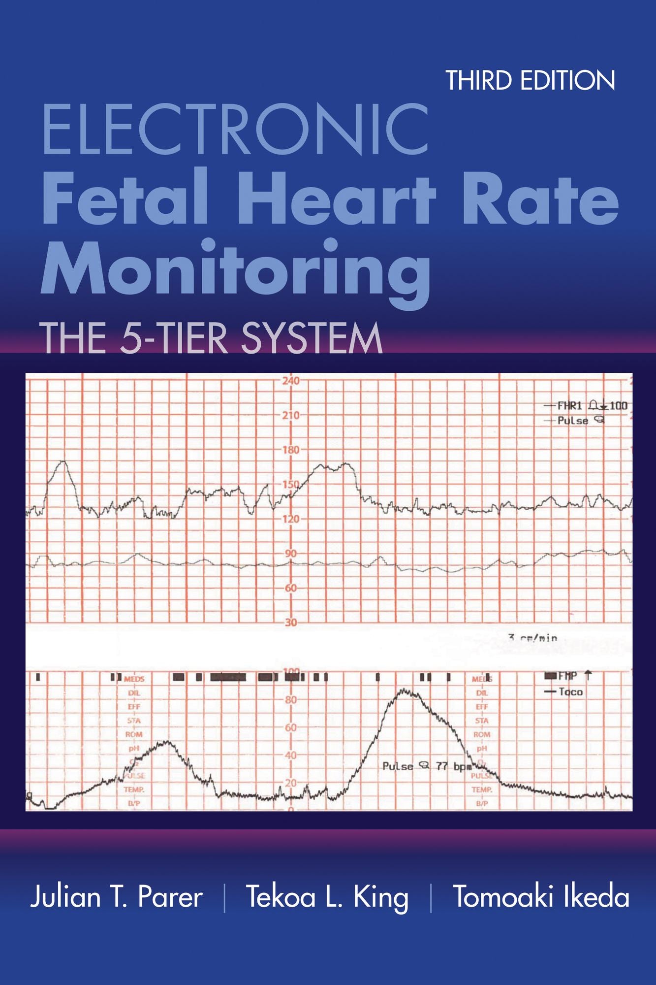 Electronic Fetal Heart Rate Monitoring: The 5-Tier System: The 5-Tier System