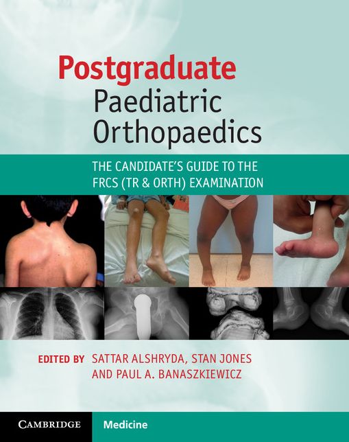 Postgraduate Paediatric Orthopaedics: The Candidate's Guide to the FRCS (Tr and Orth) Examination
