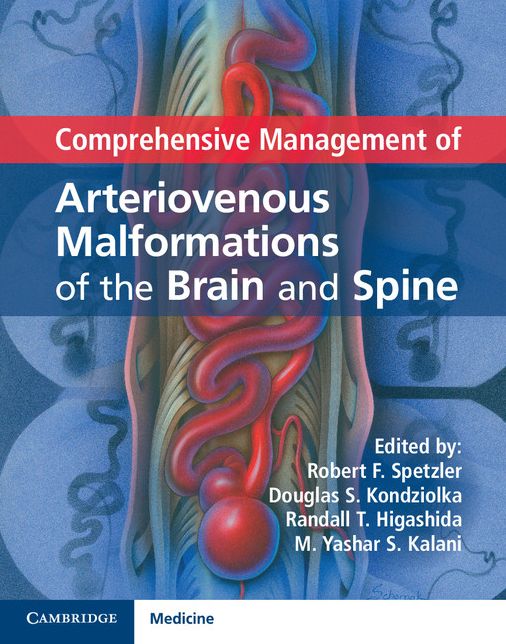 Comprehensive Management of Arteriovenous Malformations of the Brain and Spine