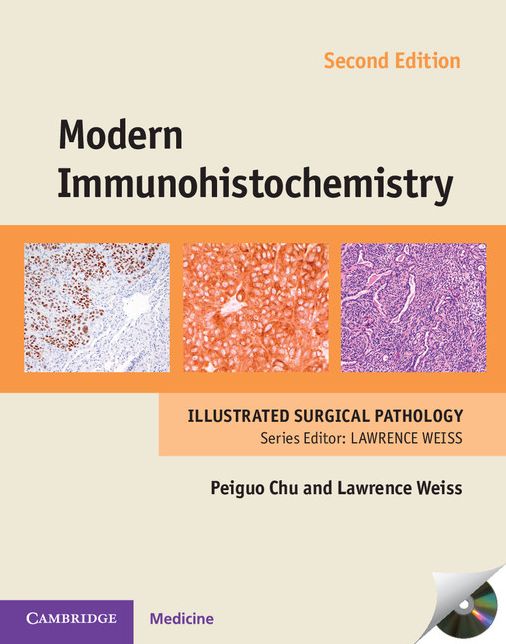 Modern Immunohistochemistry