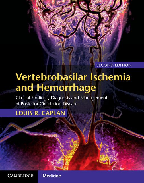 Vertebrobasilar Ischemia and Hemorrhage: Clinical Findings, Diagnosis and Management of Posterior Circulation Disease