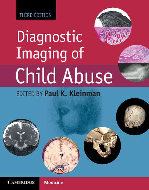 Diagnostic Imaging of Child Abuse