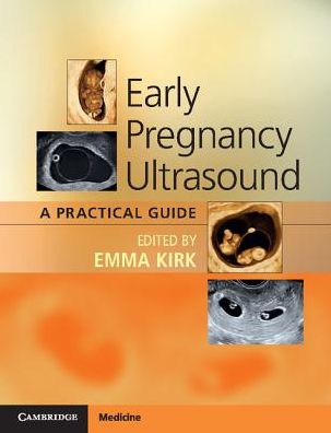Early Pregnancy Ultrasound: A Practical Guide