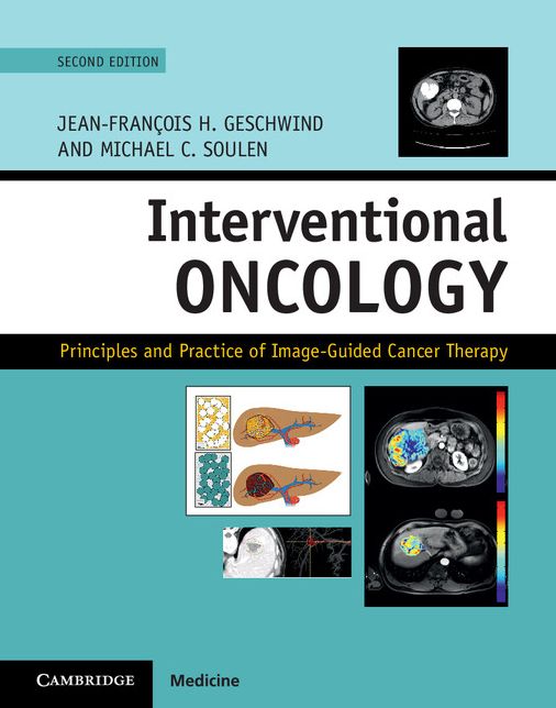 Interventional Oncology: Principles and Practice of Image-Guided Cancer Therapy