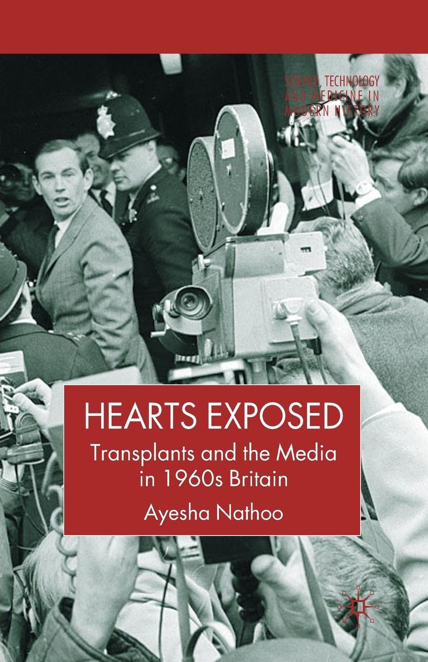 Hearts Exposed: Transplants and the Media in 1960s Britain