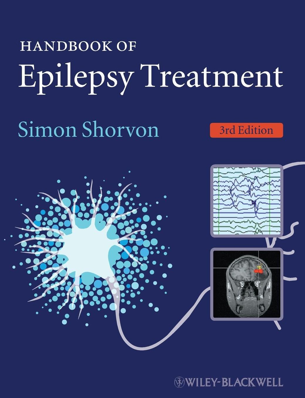 Handbook of Epilepsy Treatment