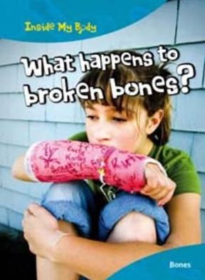 What Happens to Broken Bones?