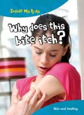 Why Does this Bite Itch?