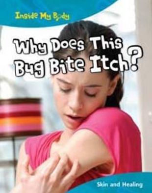 Why does this Bite Itch?
