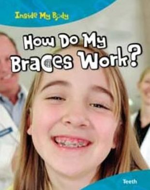 How do my Braces Work?