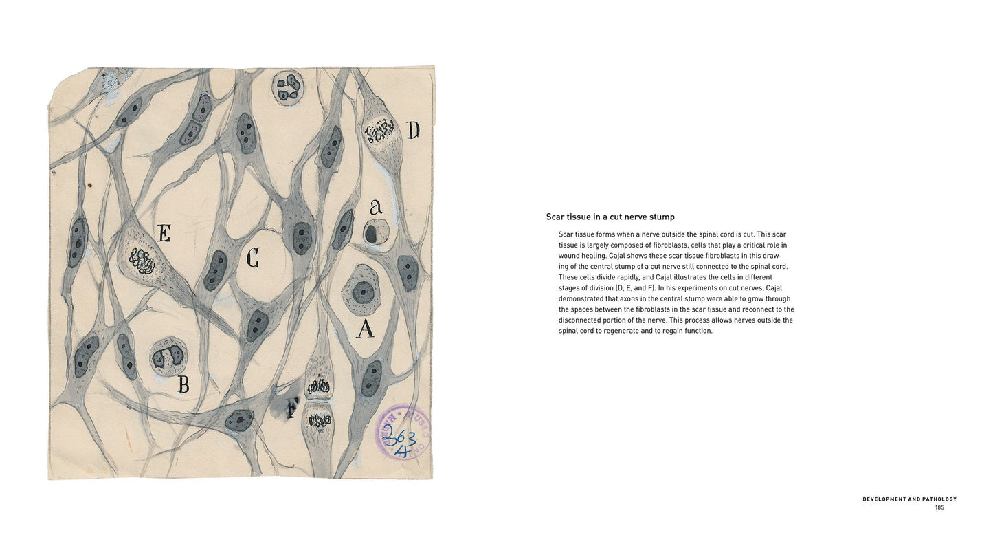 The Beautiful Brain: The Drawings of Santiago Ramon y Cajal