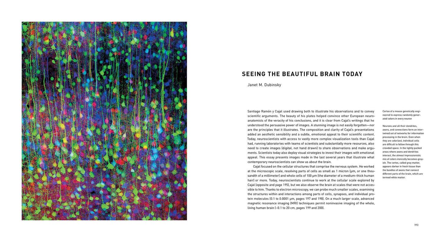 The Beautiful Brain: The Drawings of Santiago Ramon y Cajal