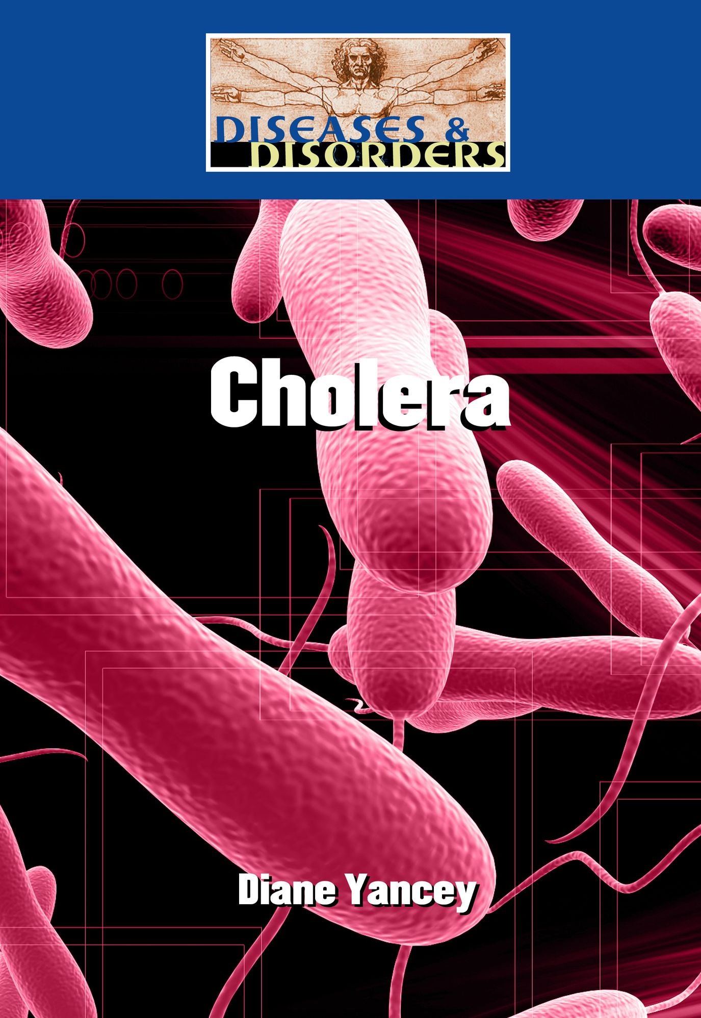 Cholera