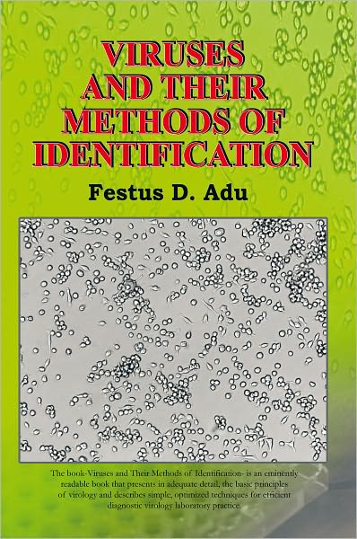 VIRUSES AND THEIR METHODS OF IDENTIFICATION