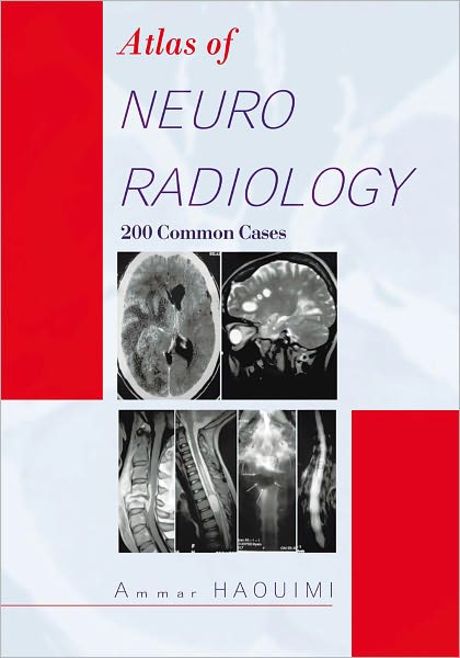 Atlas Of NEURORADIOLOGY: 200 Common Cases
