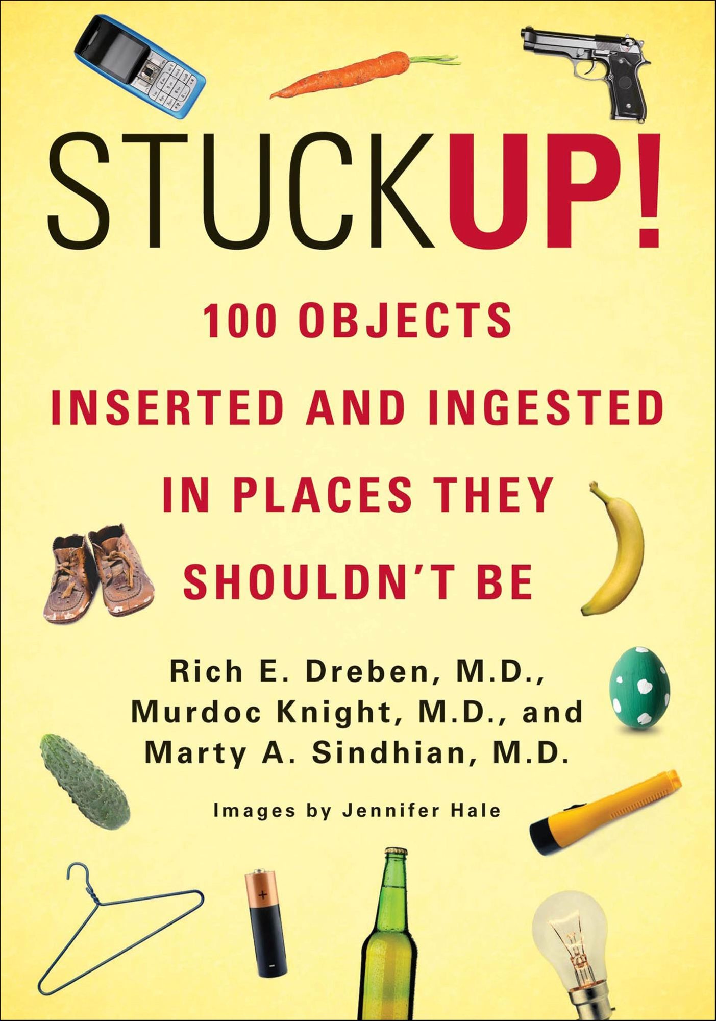 Stuck Up!: 125 Objects Inserted and Ingested in Places They Shouldn't Be