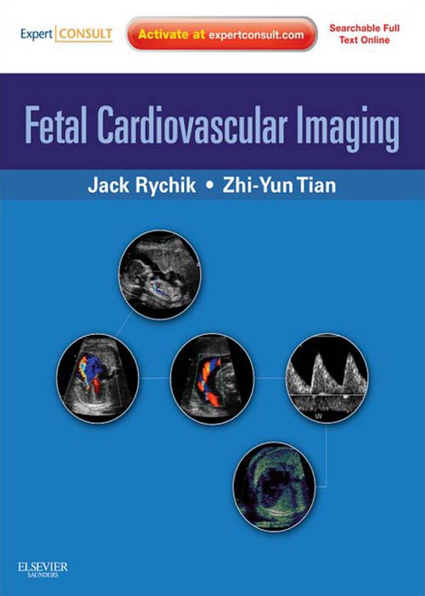 Fetal Cardiovascular Imaging E-Book: Expert Consult Premium