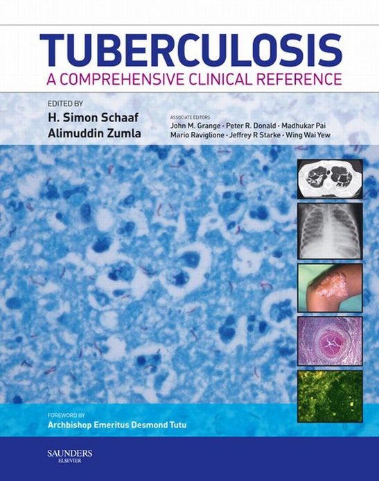 Tuberculosis E-Book: A Comprehensive Clinical Reference