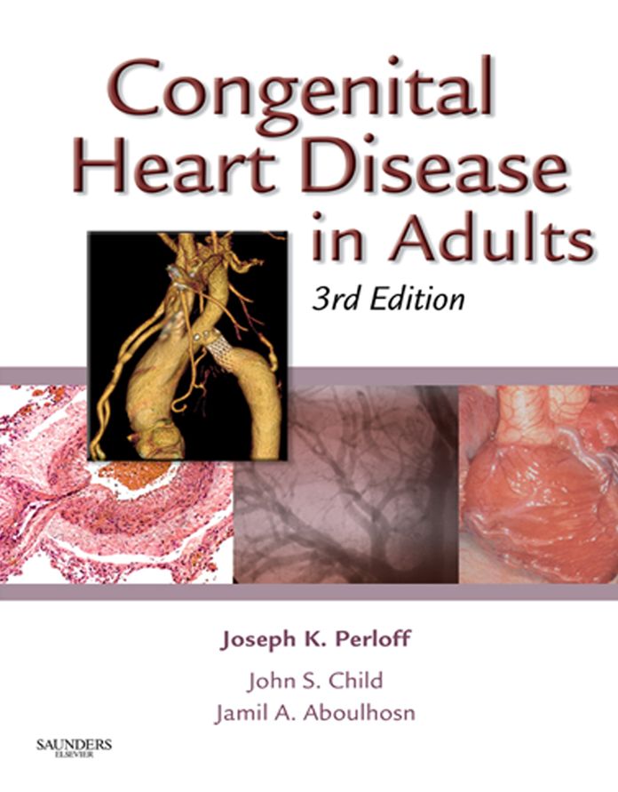 Congenital Heart Disease in Adults E-Book