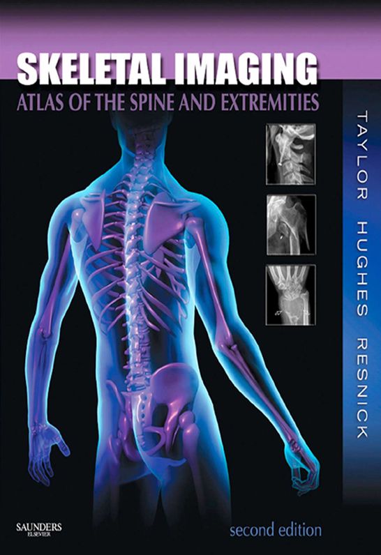 Skeletal Imaging - E-Book