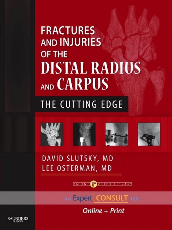 Oncoplastic Surgery of the Breast