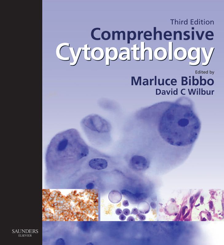 Comprehensive Cytopathology E-Book