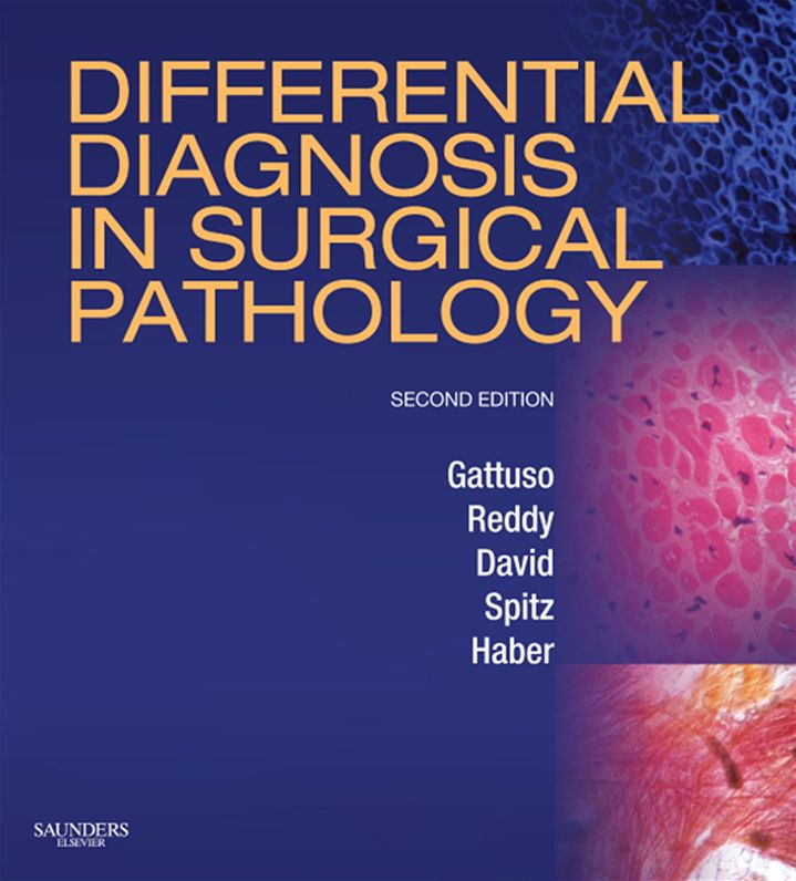 Differential Diagnosis in Surgical Pathology E-Book