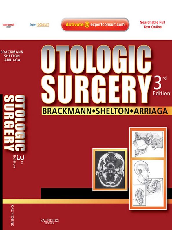 Otologic Surgery E-Book: Expert Consult - Online