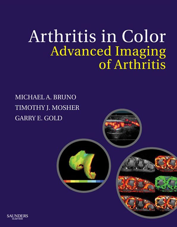 Arthritis in Color E-Book: Advanced Imaging of Arthritis