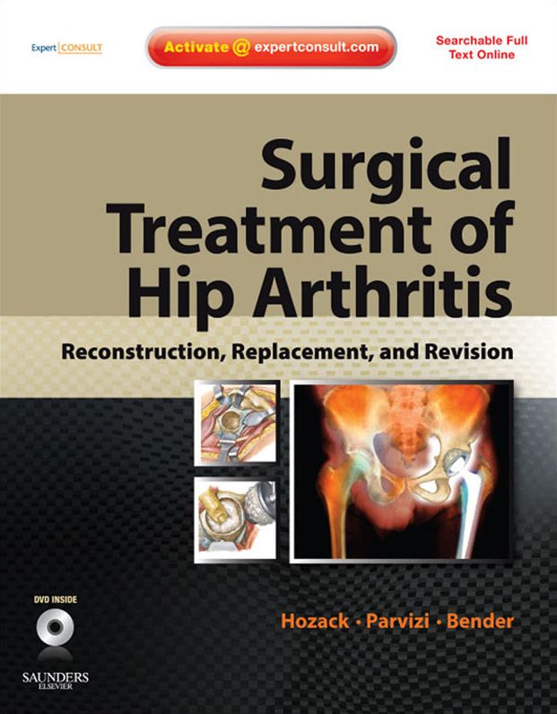Surgical Treatment of Hip Arthritis: Reconstruction, Replacement, and Revision E-Book: Expert Consult - Online and Print