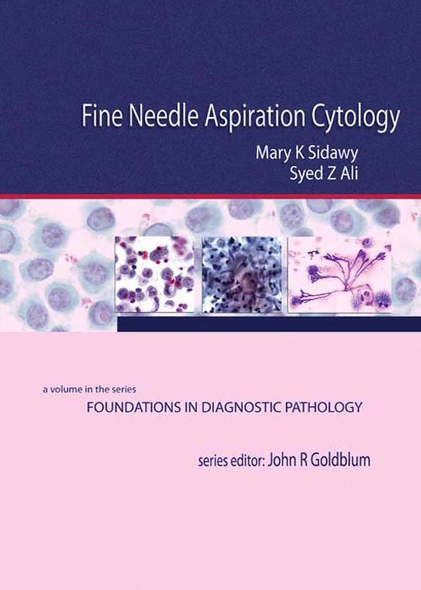 Fine Needle Aspiration Cytology E-Book: A Volume in Foundations in Diagnostic Pathology