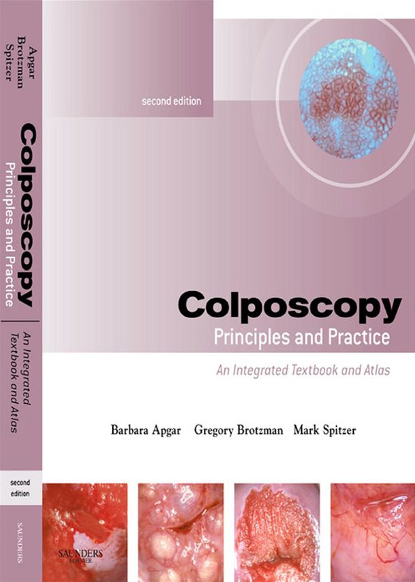 Colposcopy E-Book: Principles and Practice