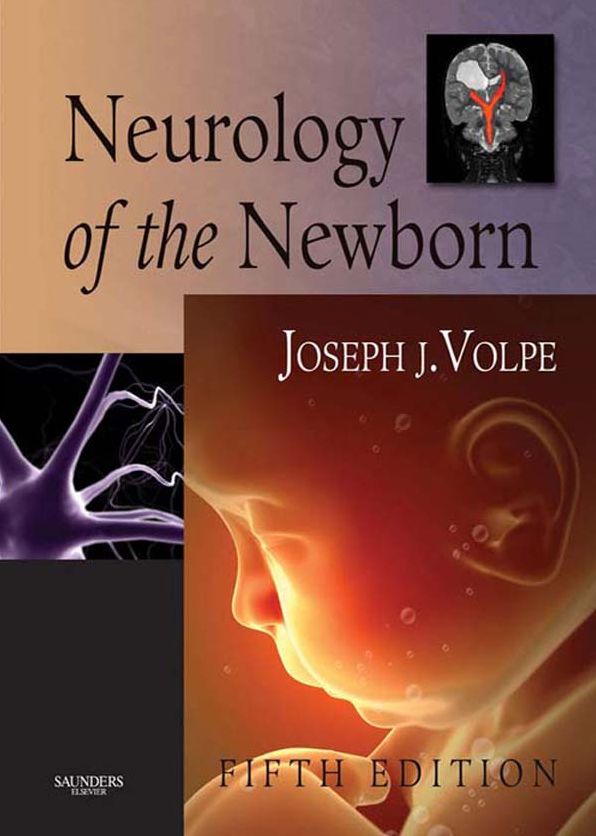 Neurology of the Newborn E-Book