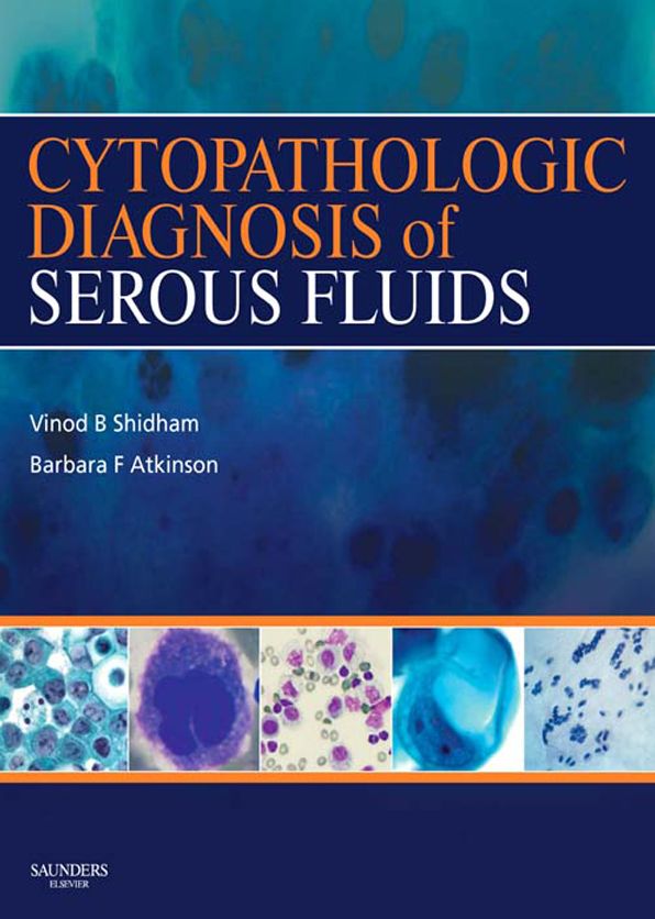 Cytopathologic Diagnosis of Serous Fluids E-Book