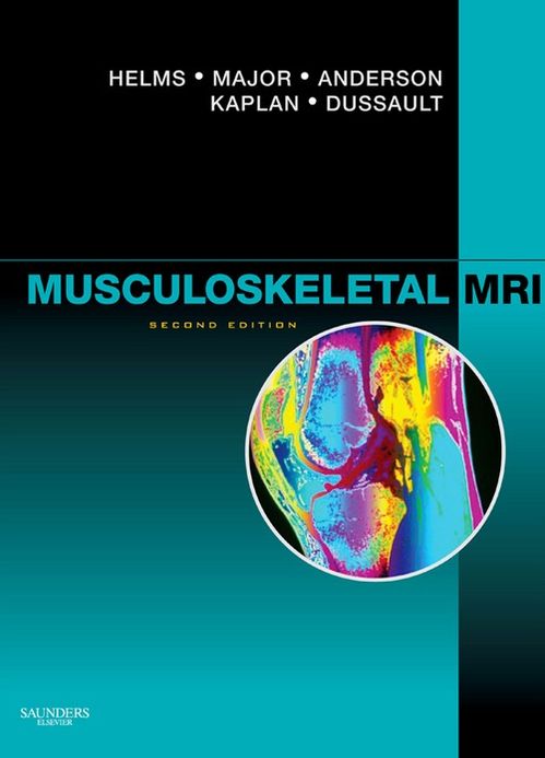 Musculoskeletal MRI E-Book