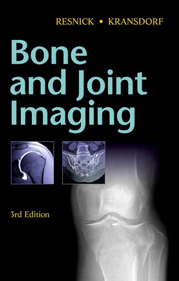 Bone and Joint Imaging E-Book