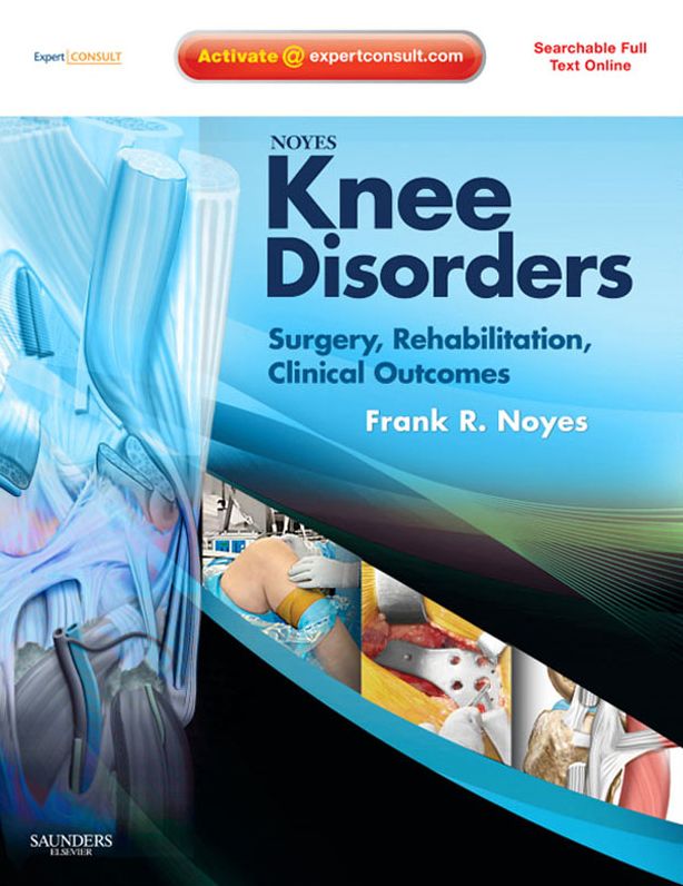 Noyes' Knee Disorders: Surgery, Rehabilitation, Clinical Outcomes E-Book