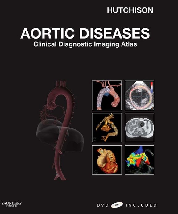 Aortic Diseases E-Book: Clinical Diagnostic Imaging Atlas