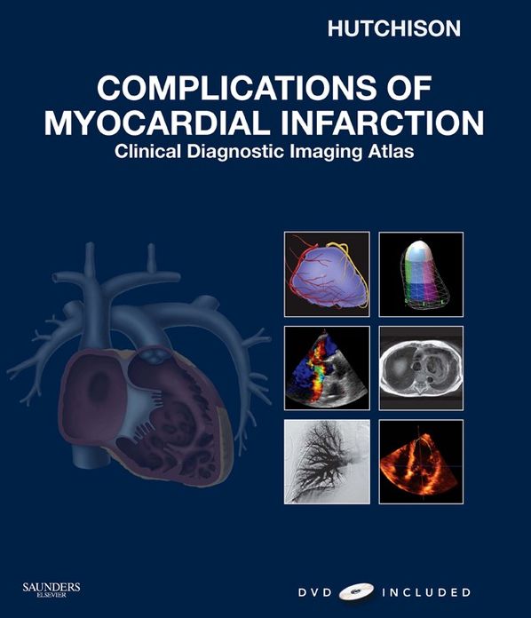 Complications of Myocardial Infarction E-Book: Clinical Diagnostic Imaging Atlas