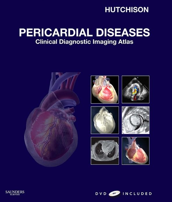 Pericardial Diseases E-Book: Clinical Diagnostic Imaging Atlas