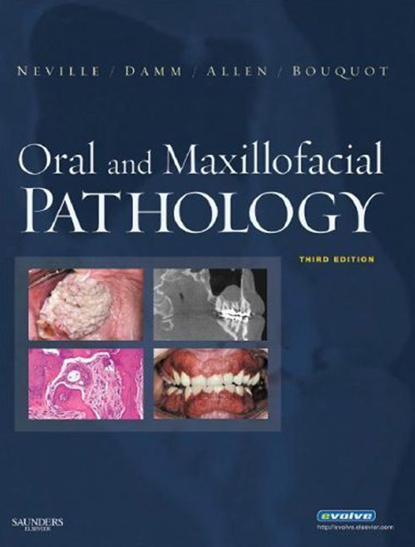Oral and Maxillofacial Pathology - E-Book