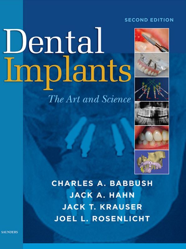Dental Implants - E-Book: The Art and Science