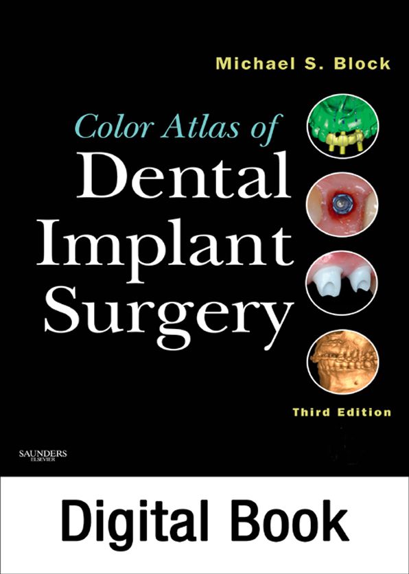 Color Atlas of Dental Implant Surgery - E-Book
