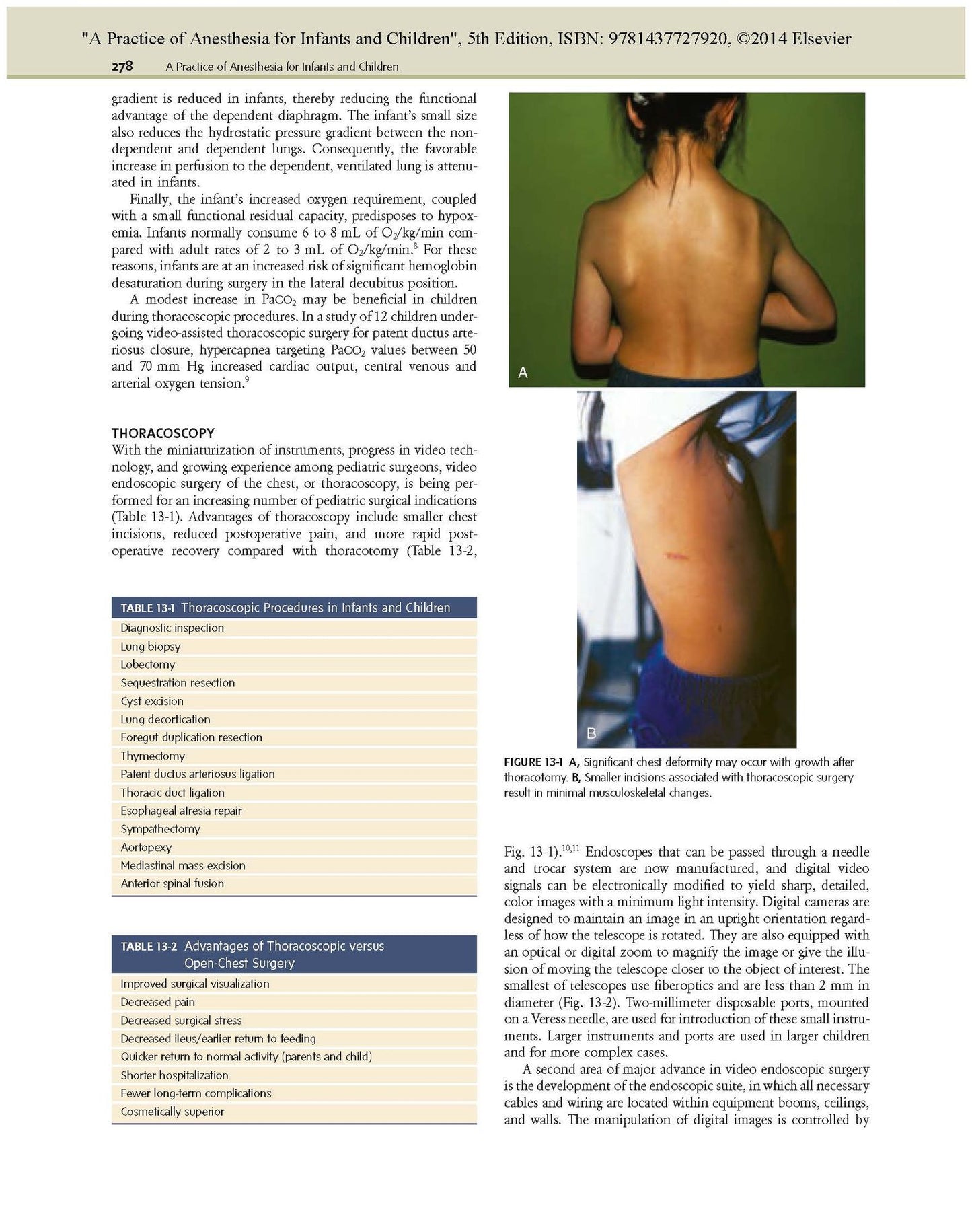 A Practice of Anesthesia for Infants and Children: Expert Consult - Online and Print