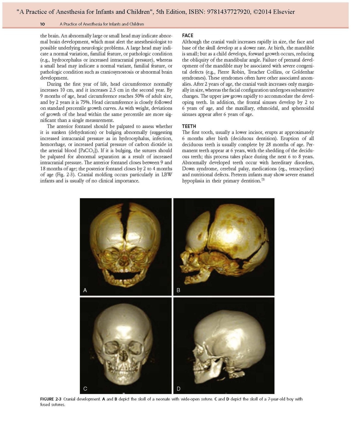 A Practice of Anesthesia for Infants and Children: Expert Consult - Online and Print