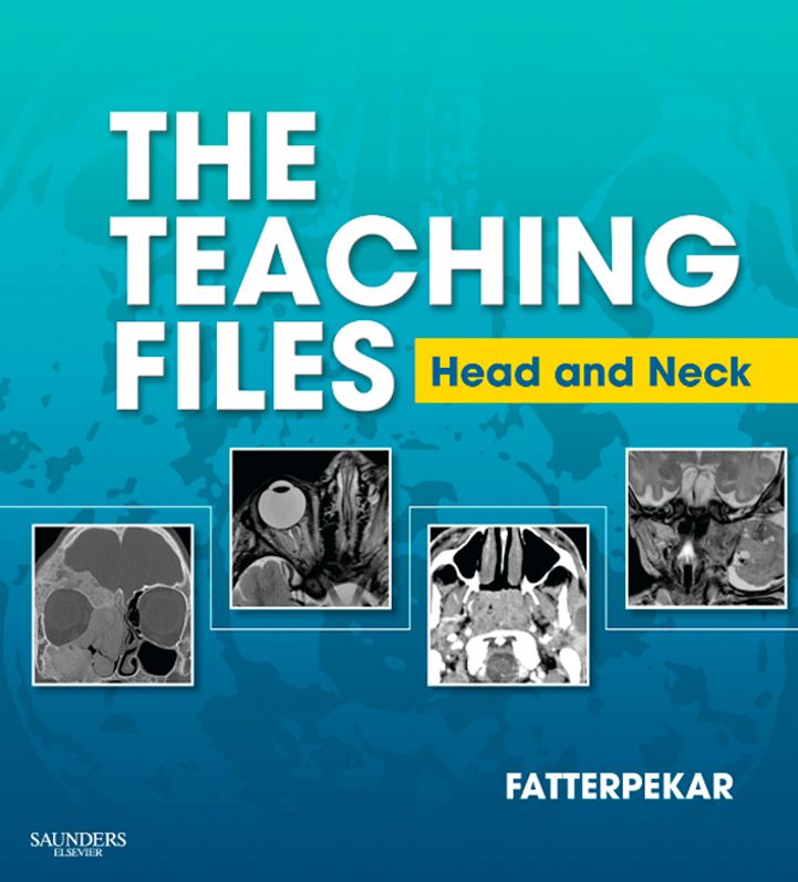 The Teaching Files: Head and Neck Imaging E-Book