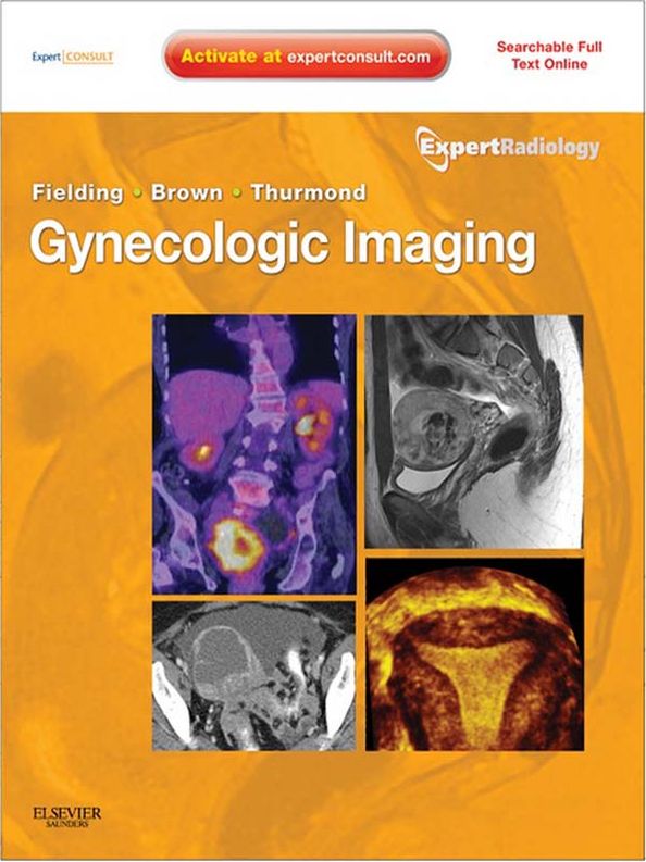 Gynecologic Imaging E-Book: Expert Radiology Series