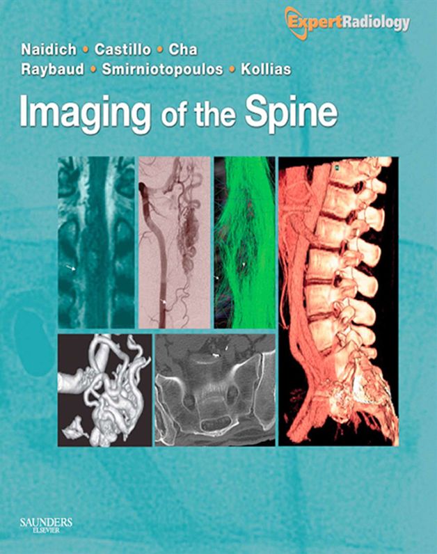Imaging of the Spine E-Book: Expert Radiology Series