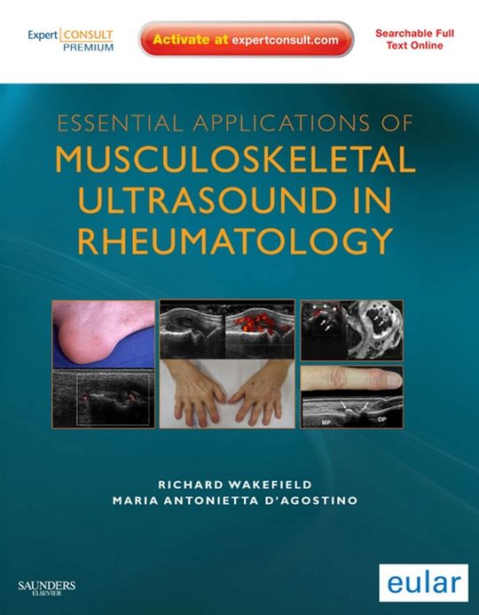Essential Applications of Musculoskeletal Ultrasound in Rheumatology E-Book: Expert Consult Premium Edition